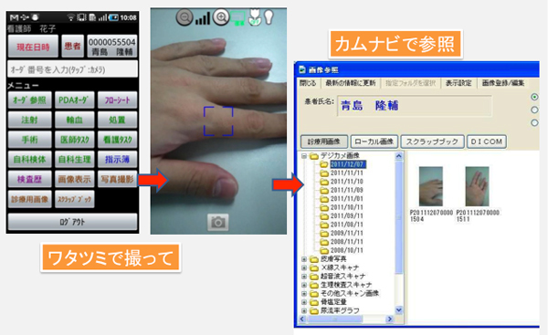 図3　電子カルテと一体化したワタツミのカメラ機能