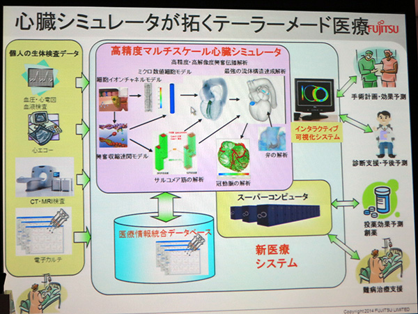 心臓シミュレータによるテーラーメード医療