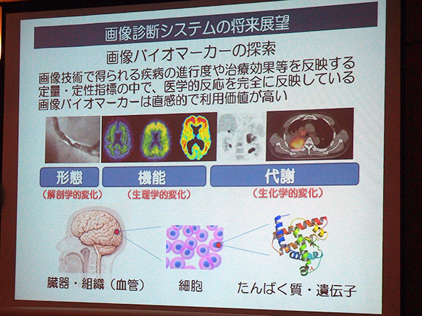 画像診断システムの将来展望