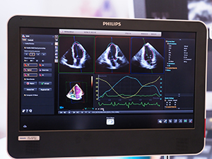 豊富な解析機能を有する“Dynamic HeartModel A.I.”