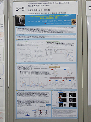 Certificate of Merit Time Enhancement Curveを用いたType II Endoleakの瘤径増大予測に関する検討 三井宏太氏（佐賀医療センター好生館）ほか