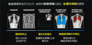 注力領域の一つである動態撮影技術