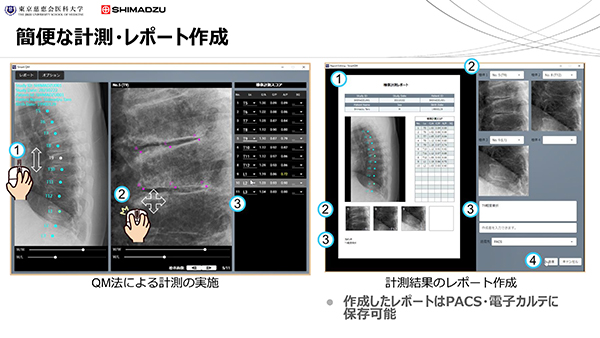 「Smart QM」のレポート作成機能