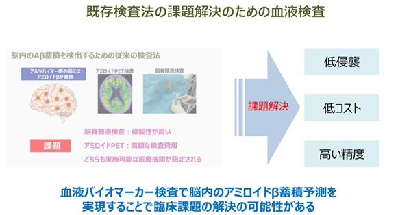 血液バイオマーカー検査が既存検査の課題を解決する可能性を示唆